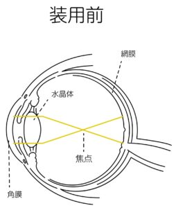 レンズ装用前