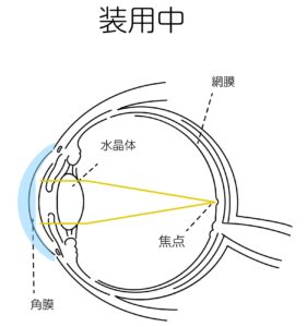 装用中